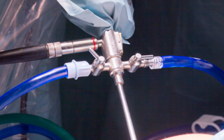 Calidad de Imagen en Cámaras de Endoscopia